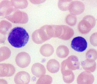 Lymphocyte Reactive