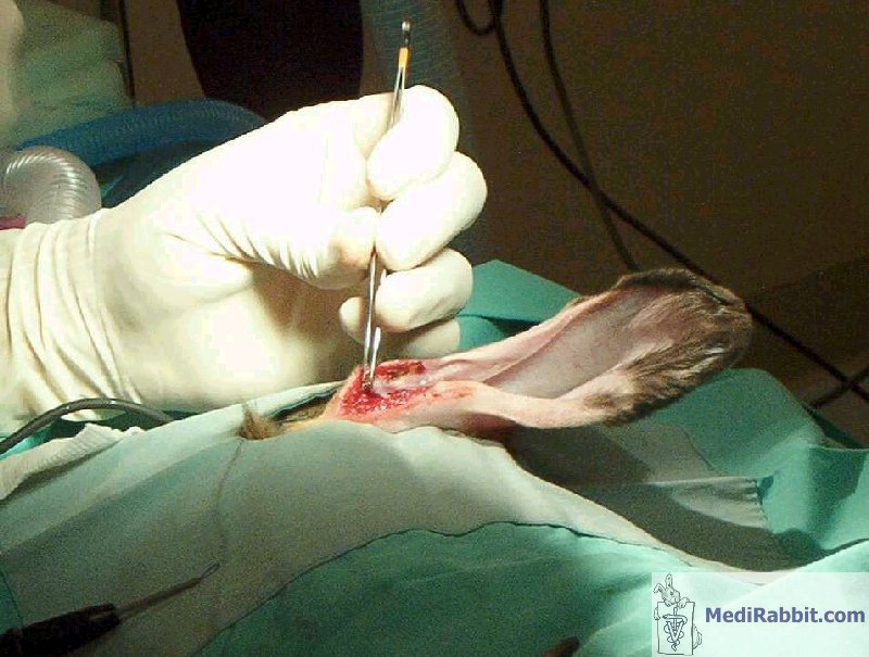 Description: C:\Users\Esther\Medirabbit\Surgical procedure\En\Ear surgery\surg2.jpg