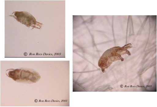 rosacea, acne, seborrhea, keratosis pilaris - demodex mite?