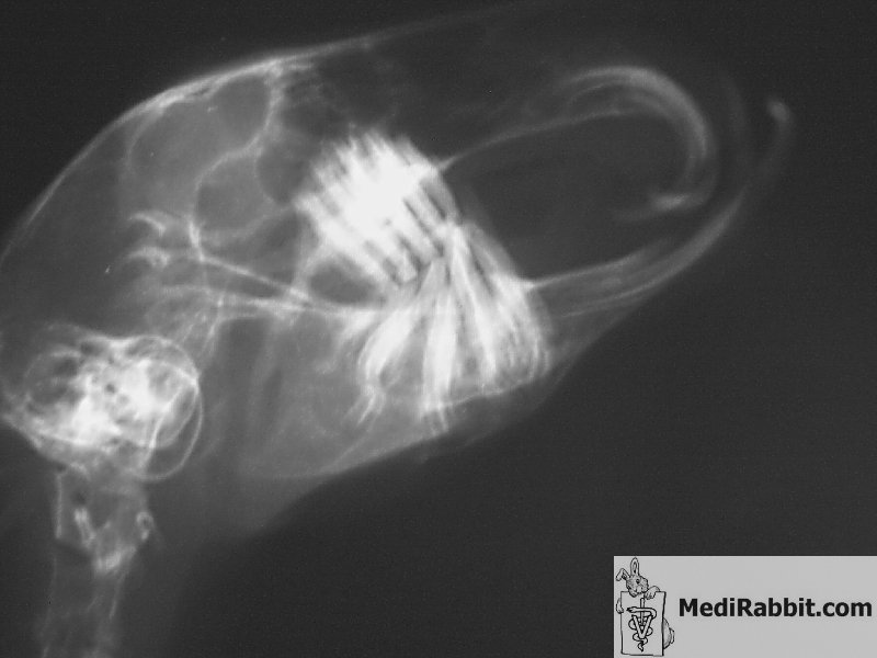 Description: C:\Users\Esther\Medirabbit\Dental_diseases\EN\Abscess\im5.jpg