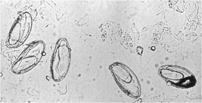 Description: C:\Users\Esther\Medirabbit\GI diseases\En\Parasitic worms\Passalurus\Pass1.jpg